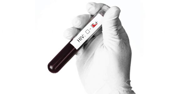 Haber | HIV İLE MÜCADELE MÜMKÜN, TANI ALDIRMAK VE HASTAYA ULAŞMAK ZOR